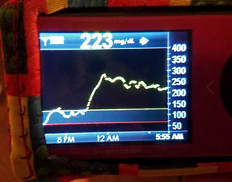 overnight blood sugar graph