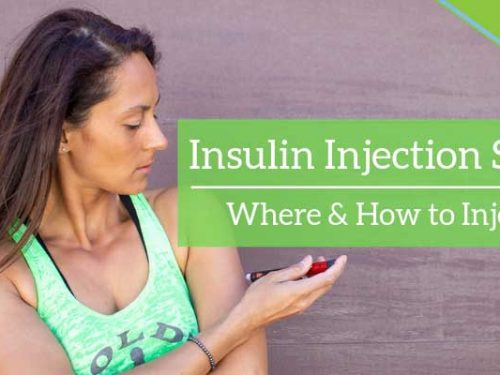 Insulin Injection Sites