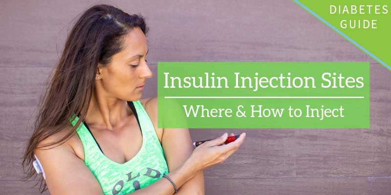 Insulin Injection Rotation Sites Chart