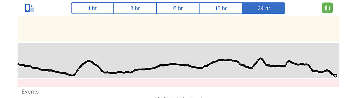 Screenshot of graph from Dexcom app