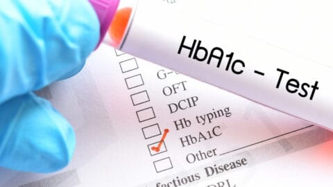 How to Lower A1c Naturally - Diabetes Strong