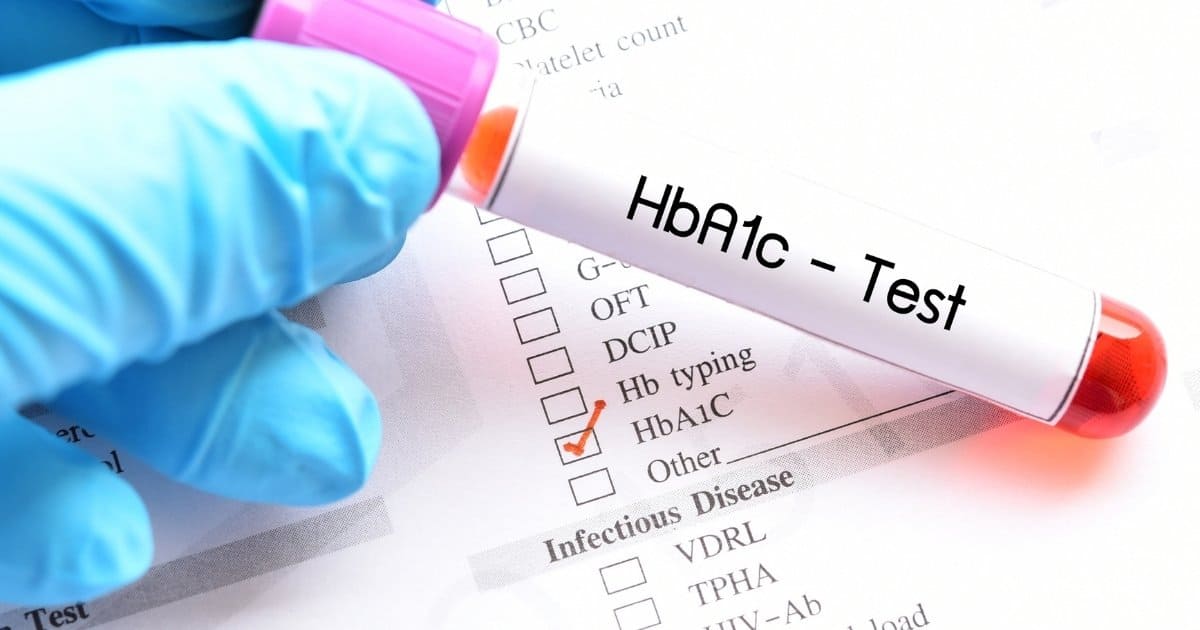 What Is a &#8220;Regular&#8221; HbA1c?