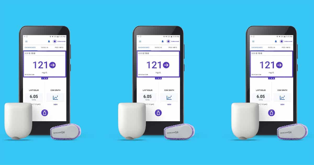 dexcom pdm