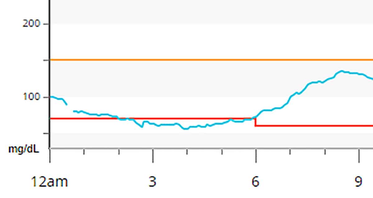 Blood sugar graph showing dawn phenomenon