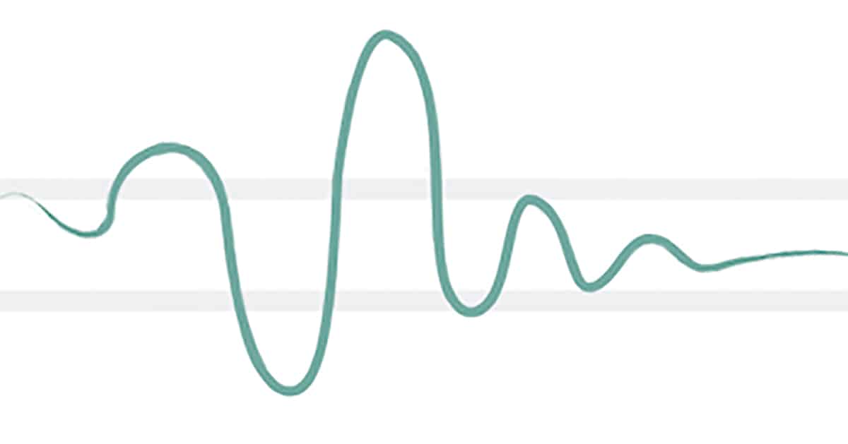 How to Use "Time In Range" to Improve Your Diabetes Management