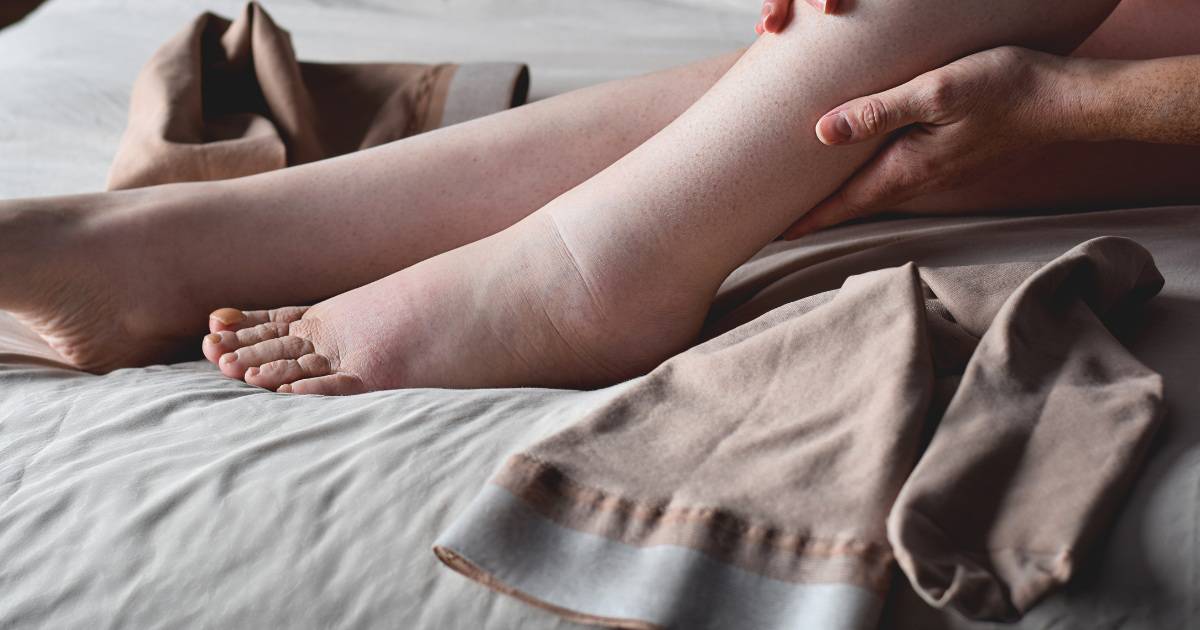 Woman with diabetes holding her swollen feet