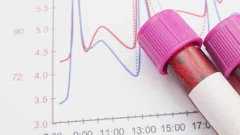 Target Blood Sugar Levels Throughout the Day